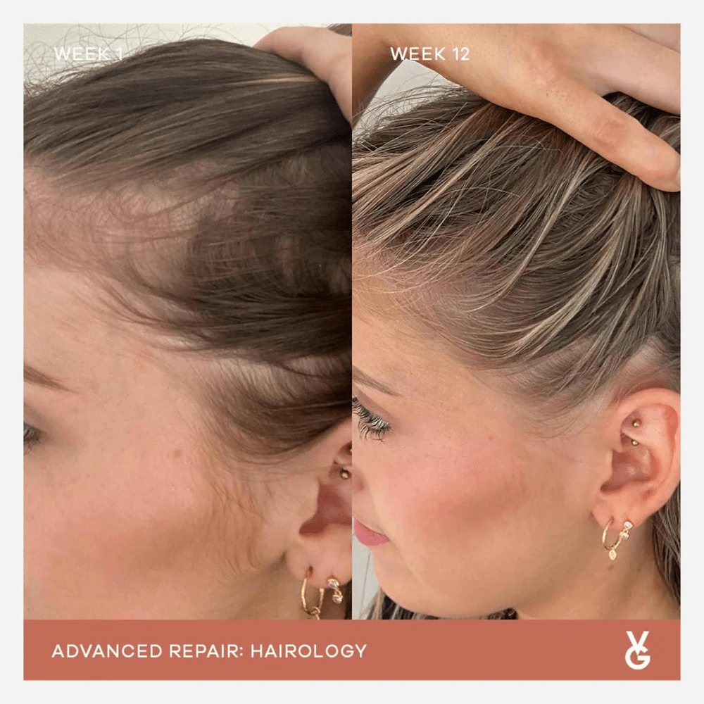 Vida Glow Hairology - PIXIEPAX