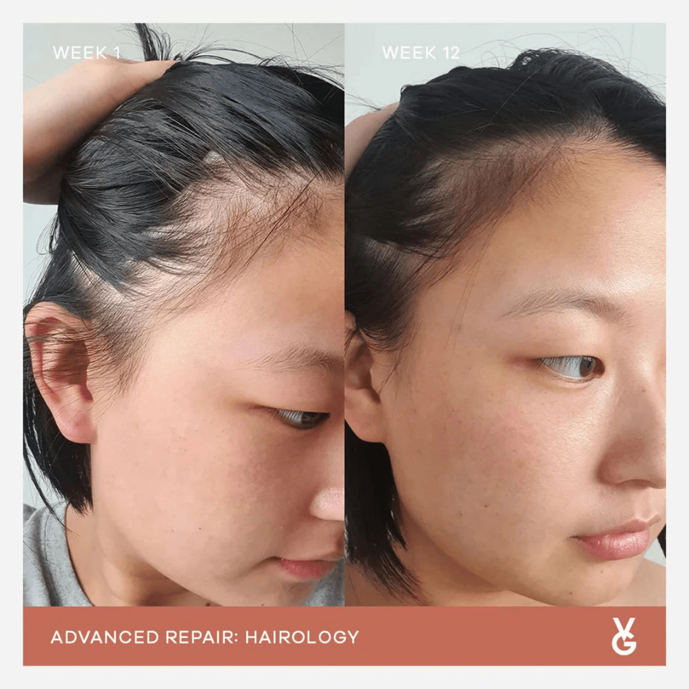 Vida Glow Hairology - PIXIEPAX