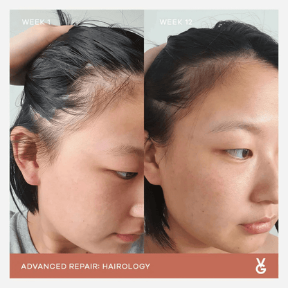 Vida Glow Hairology - PIXIEPAX