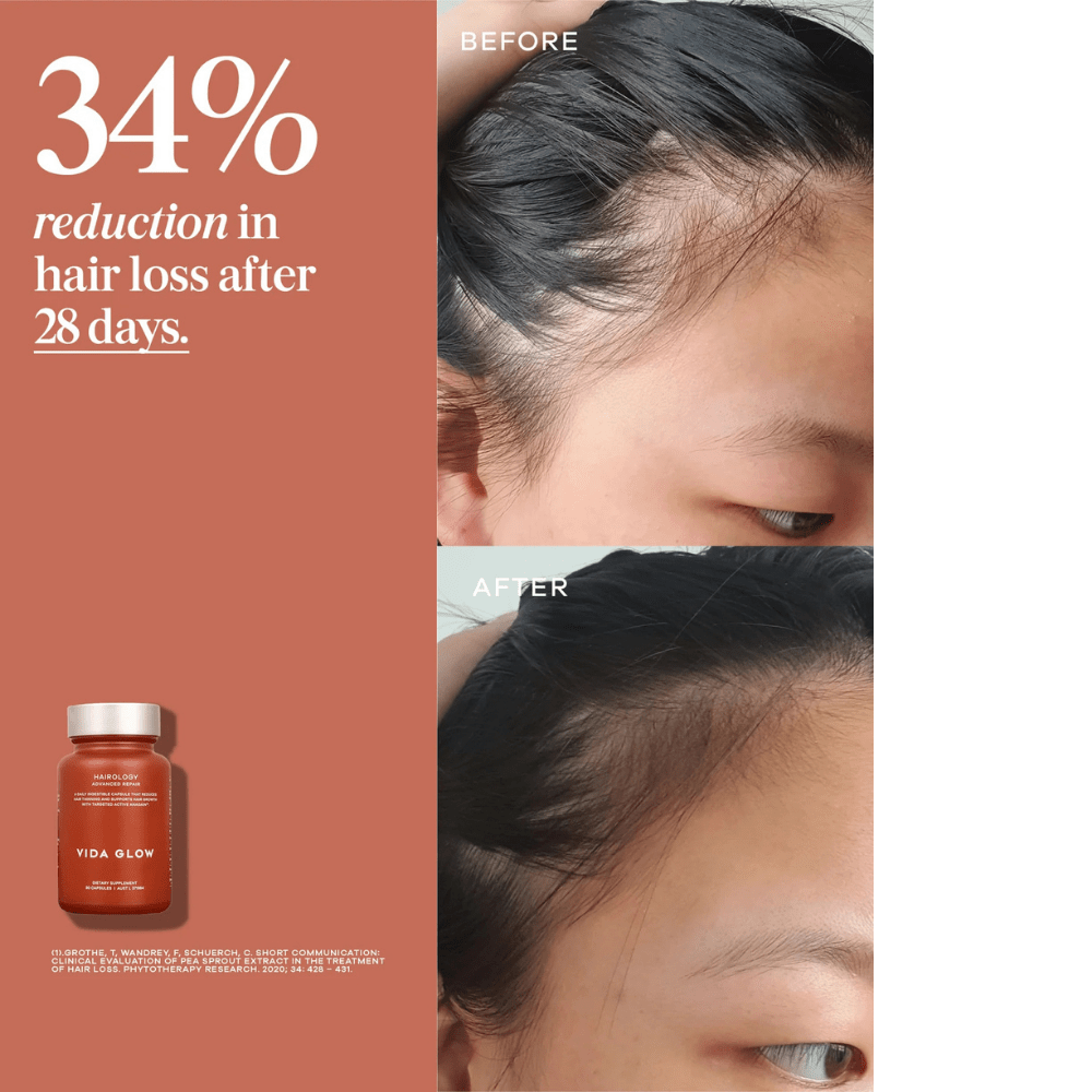 Vida Glow Hairology - PIXIEPAX