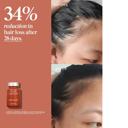 Vida Glow Hairology - PIXIEPAX