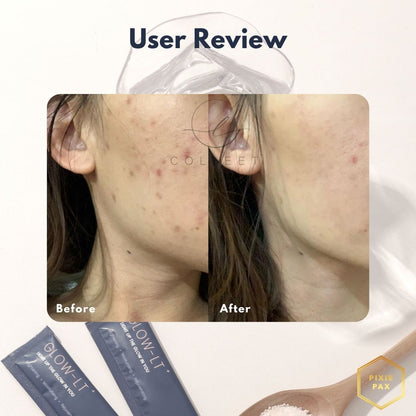 Colleet Glow LT+ - PIXIEPAX