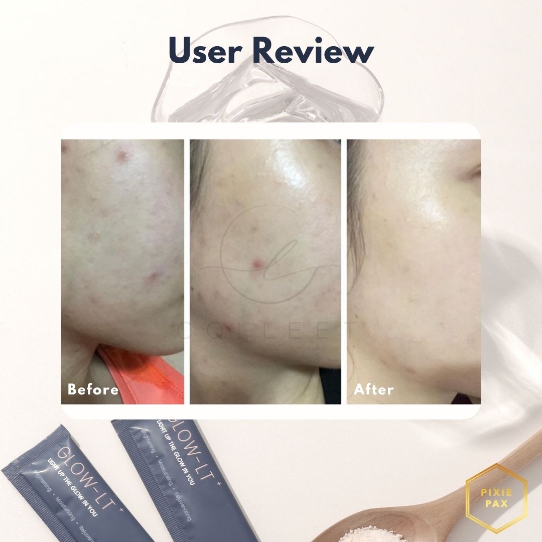 Colleet Glow LT+ - PIXIEPAX